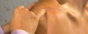 Routine Examination of the Joints Part 3: The Shoulder